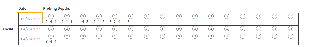 Perio exam table with yellow highlight box around the date hyperlink.